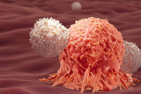 विश्व क्यान्सर दिवसः समयमै ध्यान दिए क्यान्सरबाट पनि बँच्न सकिन्छ